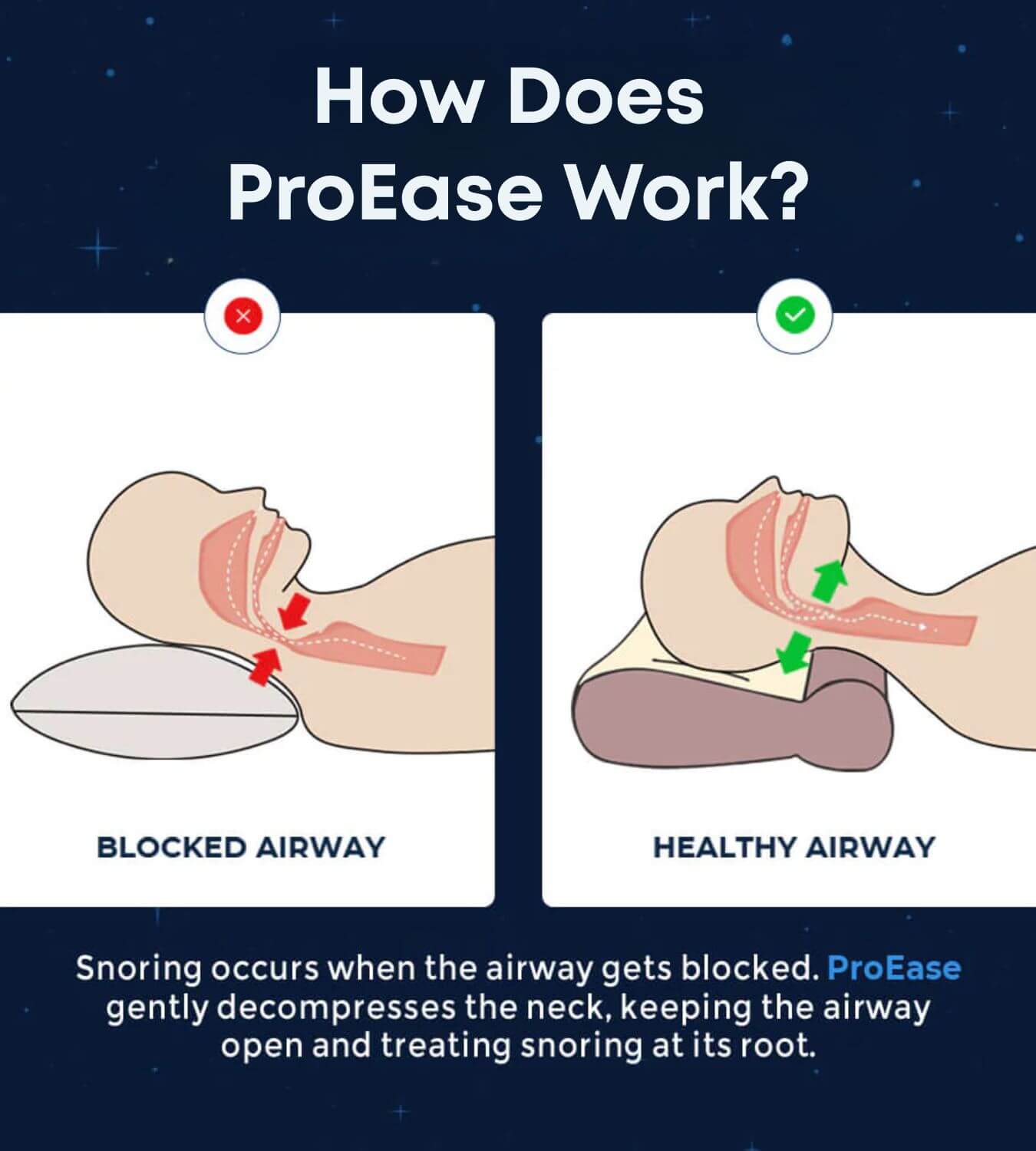 Anti-Snoring Deep Sleep Pillow